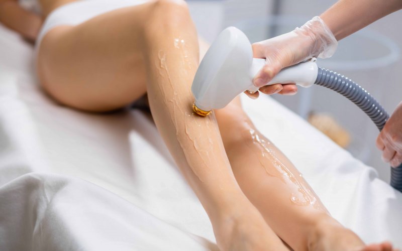 Lazer Epilasyon Nedir, Nasıl Yapılır?